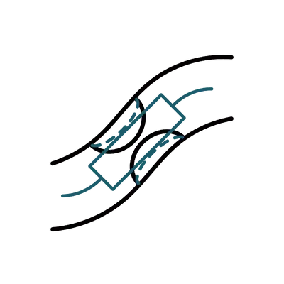 Angioplasty & Stents