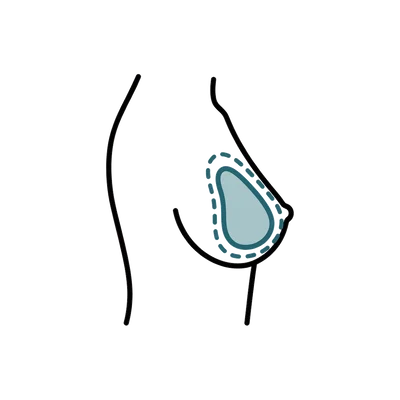 Breast Reconstruction in Thailand