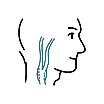 Carotid Endarterectomy