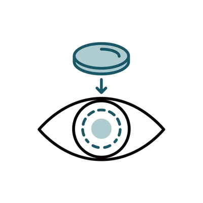 Corneal Transplant in Thailand