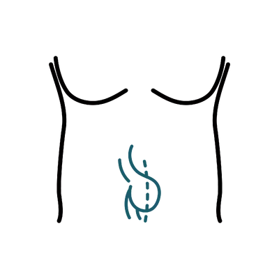 Hernia Repair in Thailand: Cost, Top Surgeons & Hospitals