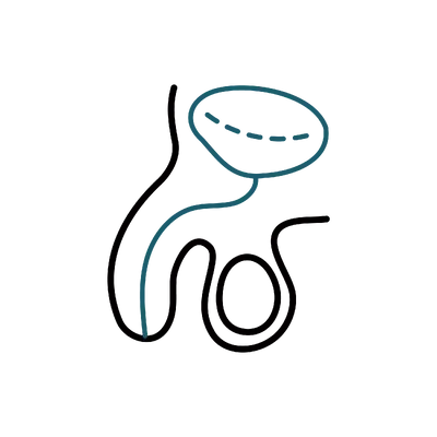 Bladder Surgery in Thailand: Cost, Top Surgeons & Hospitals