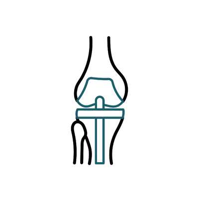 Knee Replacement in Thailand: Cost, Top Surgeons & Hospitals