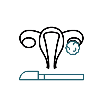 Ovarian Cyst Removal in Thailand: Cost, Top Surgeons & Hospitals