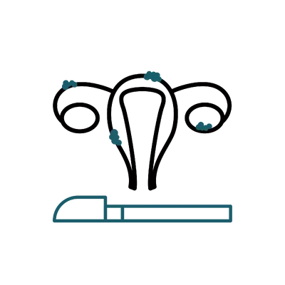 Endometriosis Surgery in Thailand: Cost, Top Surgeons & Hospitals