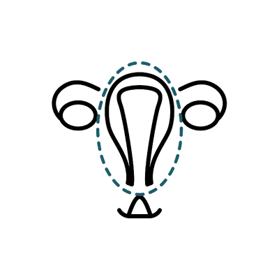 Hysterectomy in Thailand: Cost, Top Surgeons & Hospitals