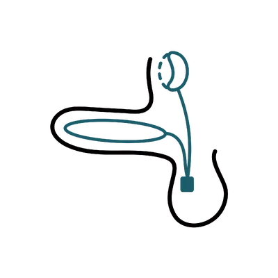 Penile Implant in Thailand: Cost, Top Surgeons & Hospitals