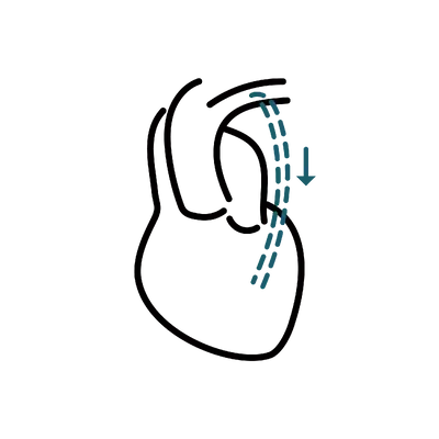 Bypass Surgery in Thailand: Cost, Top Surgeons & Hospitals