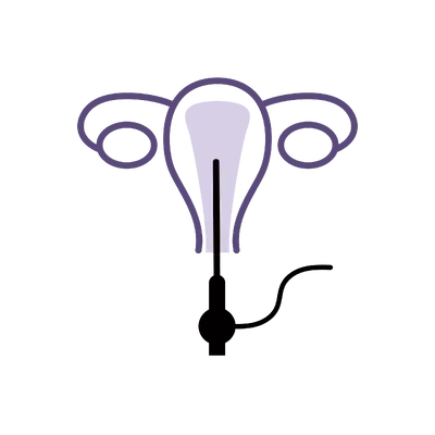 Hysteroscopy