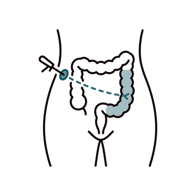 Laparoscopic (Minimally Invasive) Colorectal Cancer Surgery in Thailand