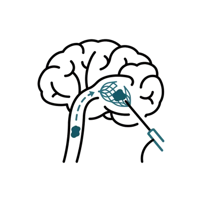 Mechanical Thrombectomy in Thailand