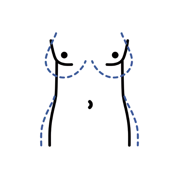 Body Feminization