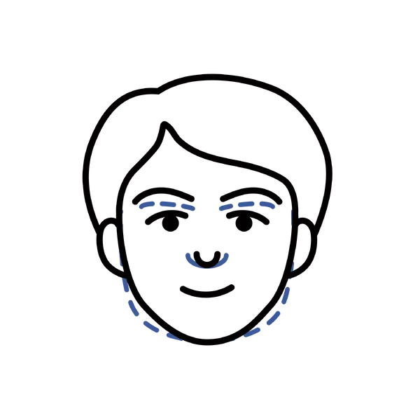 Facial Masculinization Surgery