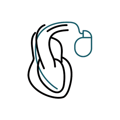 Pacemaker Implant