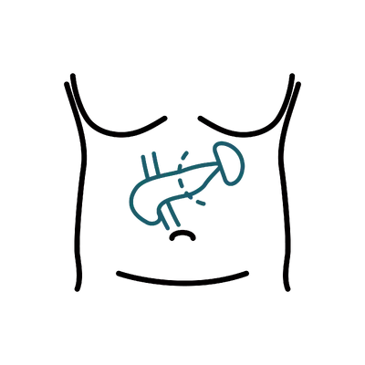 Pancreatectomy