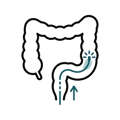 Flexible Sigmoidoscopy in Thailand