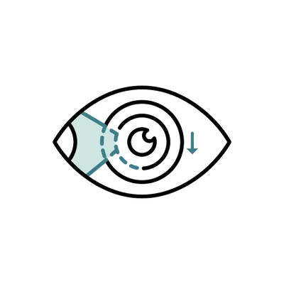 Surfer's Eye Surgery in Thailand